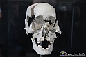 VBS_3116 - Ossa craniche - Mostra Body Worlds